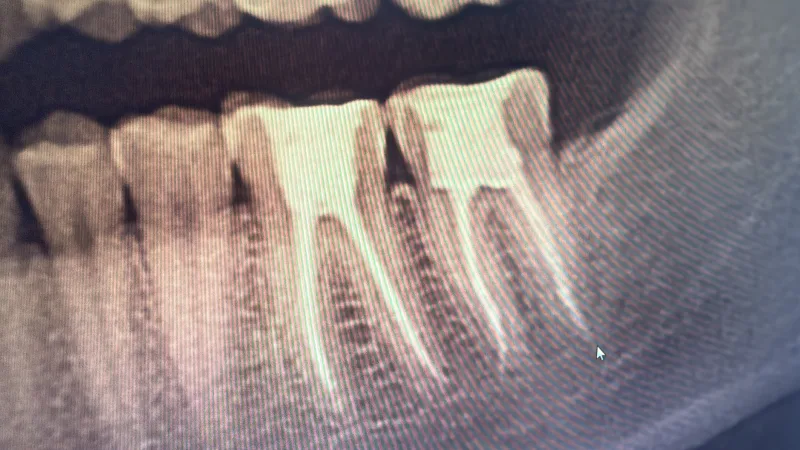 Alanya HEALTHY TEETH Dental Aesthetic — Medicina em Alanya: Encomenda online, preços e comentários